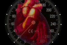 Hypertension : Causes et facteurs de risque